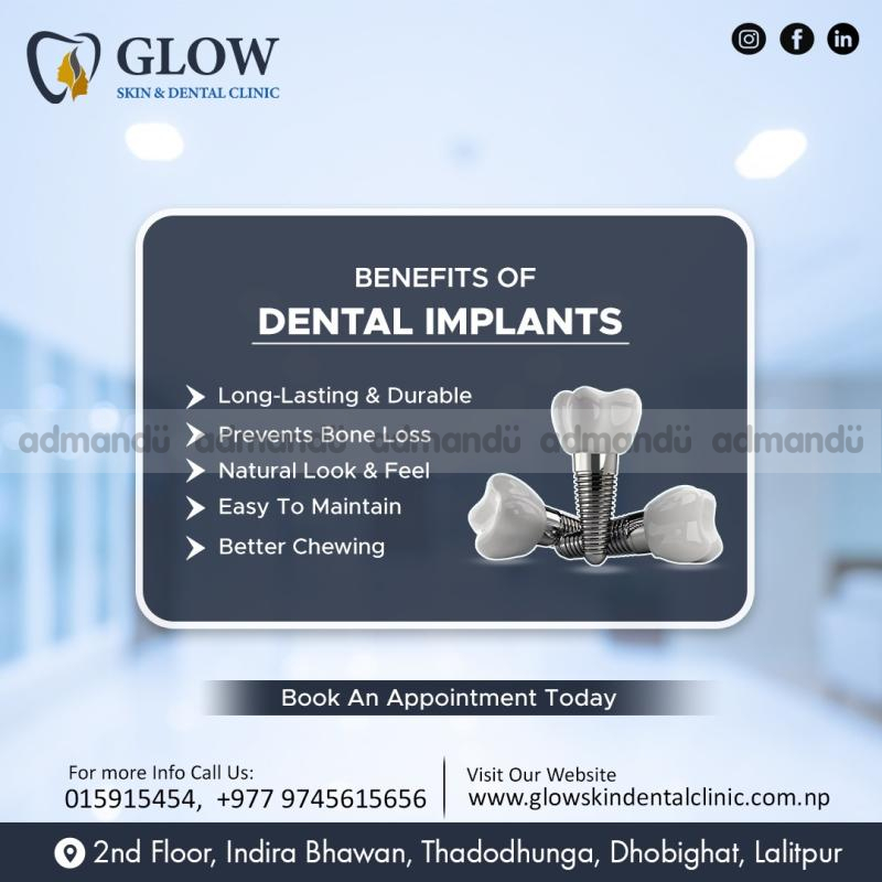 Benefits of Dental Implants with Glow Skin & Dental clnic