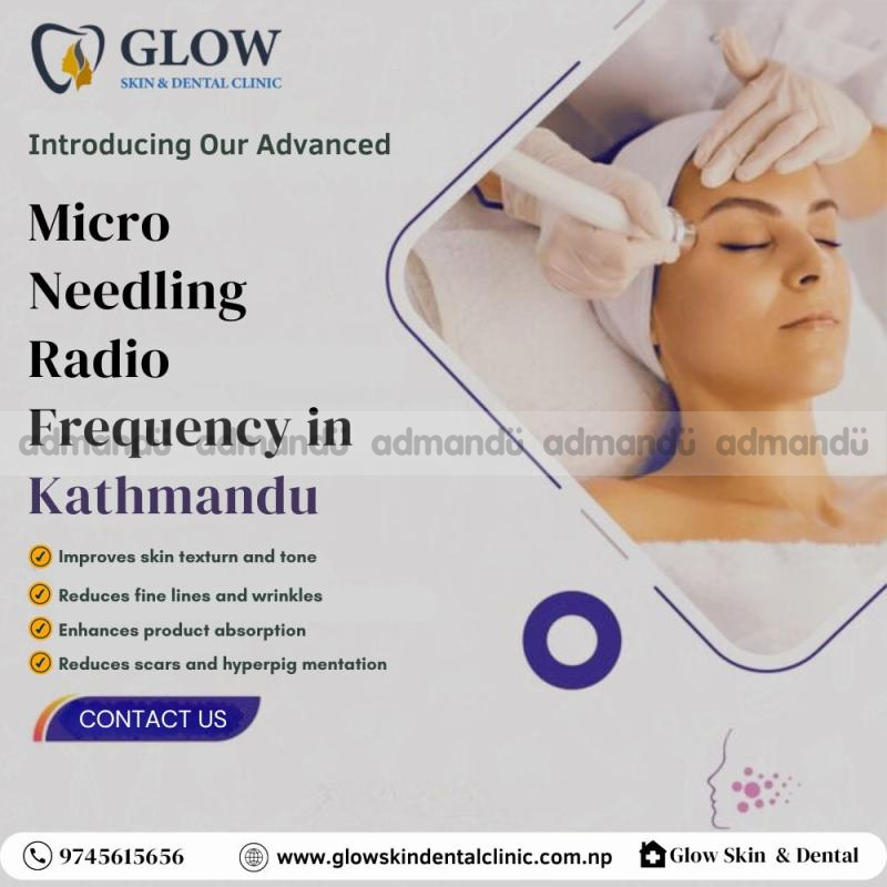 Micro Needling Radio Frequency in Kathmandu